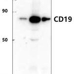 CD19 (D424) polyclonal antibody
