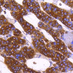 Calreticulin Recombinant Rabbit Monoclonal Antibody (SU37-03)