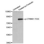 CTNNB1 (pY333) Antibody