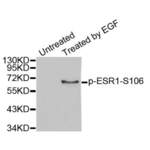 ESR1 (pS106) Antibody