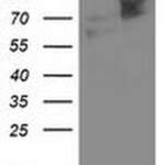 ALDH3A2 Monoclonal Antibody (OTI 1B11), TrueMAB™