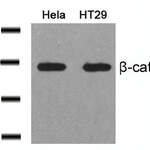 CTNNB1 (Ab-41/45) Antibody