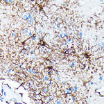 GFAP Recombinant Rabbit Monoclonal Antibody (ARC0206)