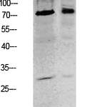 Tau (Phospho-Ser396) Antibody