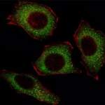 p65 Antibody (RELA)