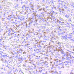 NOXA Recombinant Rabbit Monoclonal Antibody (JA30-03)