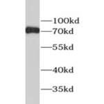 Estrogen Receptor (ESR1) Antibody