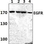 EGFR (P1019) polyclonal antibody