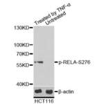 RELA (pS276) Antibody