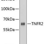 TNFRSF1B Antibody #32155