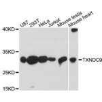 Thioredoxin Domain-Containing Protein 9 (TXNDC9) Antibody