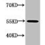 Acetyl-RELA (K218) Antibody