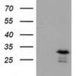 RASD2 monoclonal antibody
