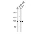 Angiotensin-Converting Enzyme 2 (ACE2) Antibody