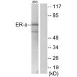 Estrogen Receptor Alpha (ESR1) Antibody