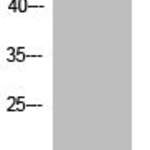 Acetyl-Histone H3 (K14) Antibody