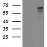 ALDH3A2 Monoclonal Antibody (OTI1D1), TrueMAB™