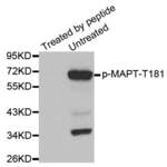 Anti Phospho MAPT T181 Antibody