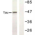 MAPT / Tau Antibody (Ser422)