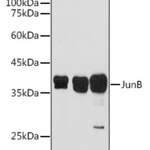 JunB polyclonal antibody