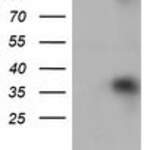 ZFP36 monoclonal antibody