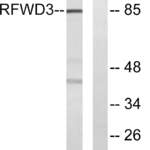 RFWD3 Polyclonal Antibody