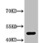 Acetyl-TP53 (K370) Antibody