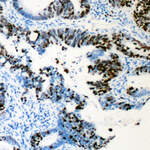 Anti-RUNX1 (pS276) Antibody
