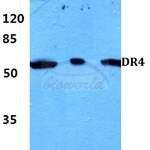 DR4 (D430) polyclonal antibody 