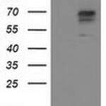 ALDH3A2 Monoclonal Antibody (OTI1H4), TrueMAB™
