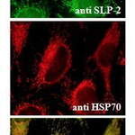 SLP-2 (Stomatin-like Protein 2, EPB72-like 2)