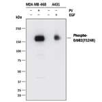 Human Phospho-ErbB2/Her2 (Y1248) Antibody