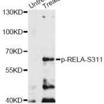 Anti Phospho RELA S311 Antibody