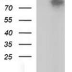 CD44 monoclonal antibody