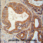 CSGALNACT1 Antibody (Center)