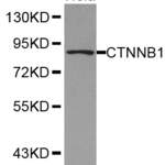 CTNNB1 antibody #38350