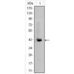 Catenin Beta 1 (CTNNB1) Antibody