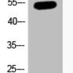 Acetyl-TP53 (K382) Antibody