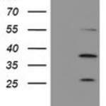 PSMB7 (Proteasome 20S beta 7 ) monoclonal antibody