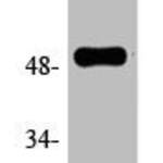 Phospho-TP53 (S6) Antibody