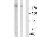 Anti-ErbB2 / HER2 (phospho Y877) antibody (ab47262)