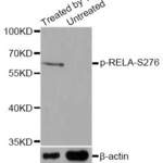 Anti Phospho RELA S276 Antibody