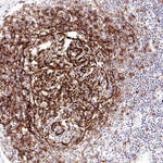 CD23 Recombinant Rabbit Monoclonal Antibody (PD00-03)