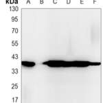CD326 Rabbit monoclonal antibody