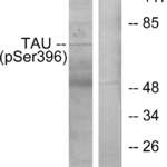 MAPT Antibody (Phospho-Ser396) (OAAF00390)