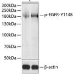 EGFR (phospho-Y1148) polyclonal antibody