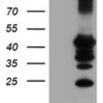 PTPN1 (PTP1B) monoclonal antibody
