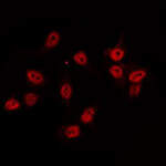 AKIP1 Polyclonal Antibody