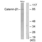 Catenin Beta (CTNNB1) Antibody