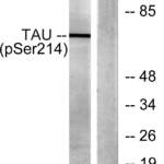 Tau (phospho Ser214) Polyclonal Antibody